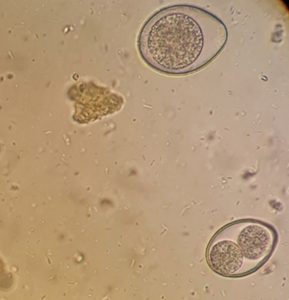 Intestinal Coccidia - Troccap